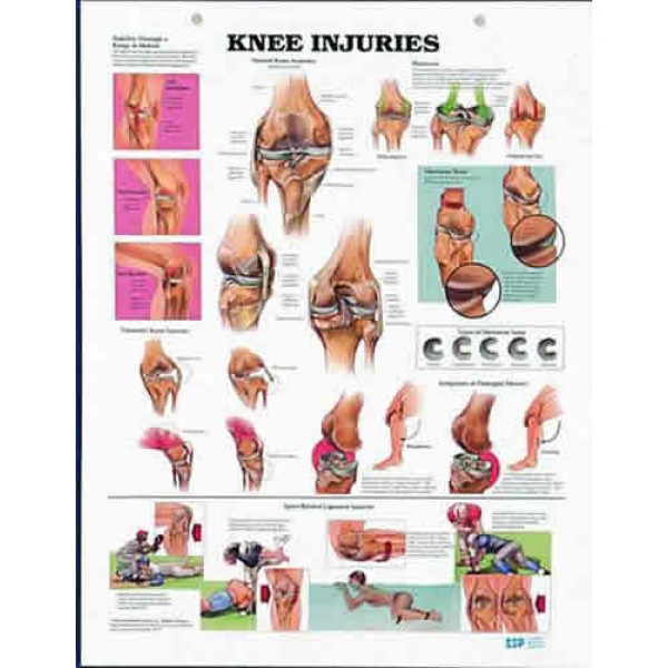 Knee Injuries Chart