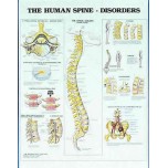 Human Spine Disorders Chart