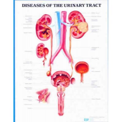 Diseases Of Urinary Tract