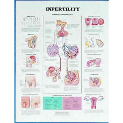 Infertility Chart Infertility Chart