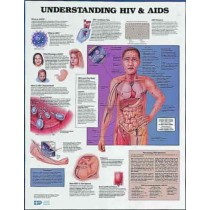 Aids Chart