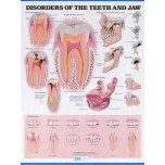 Disorders Of Teeth and Jaw Chart