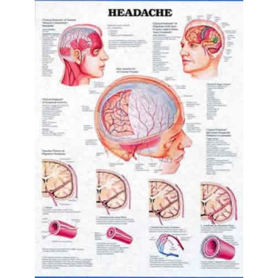 Headache Chart