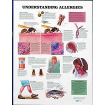 Understand Allergies Chart