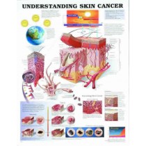 Understanding Skin Cancer Chart
