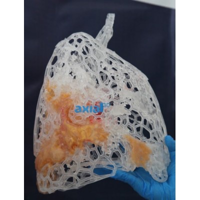 3D Printed COVID-19 Lungs Full Size Mesh