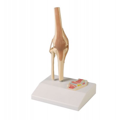 Knee Joint, 1/2 Life Size with Cross Section