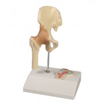 Hip Joint, 1/2 Life Size with Cross Section