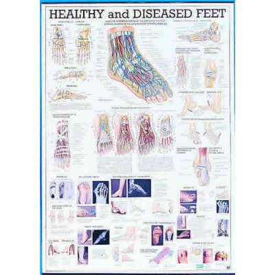 Healthy & Diseased Feet Chart