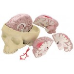 Brain and Partial Skull Budget Model