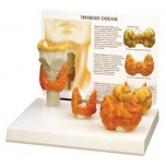 Thyroid Model Set of Four Budget Model