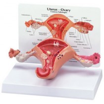 Uterus/Ovary Budget Model