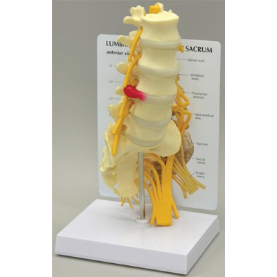 5-Pc. Lumbar Vertebrae with Sacrum - Budget Model