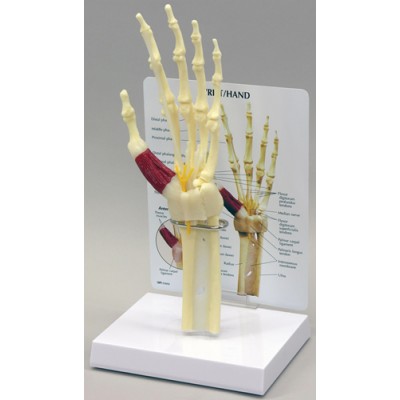 Hand/Wrist - Carpal Tunnel Syndrome - Budget Model