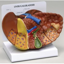 Liver Cancer - Budget Model