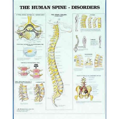 Human Spine Disorders Chart