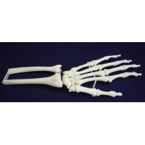 Wrist Joint Movable