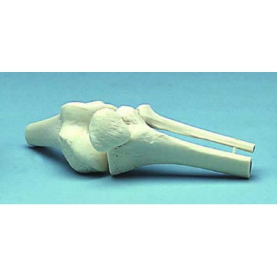 Knee Joint Movable