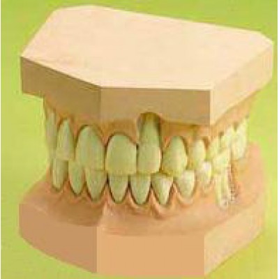 Upper And Lower Teeth Set Model