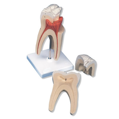 Upper Molar Tooth 3 Part