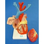 Heart Enlarged, Flexible Model