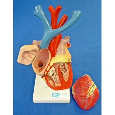 Heart Enlarged, Flexible Model