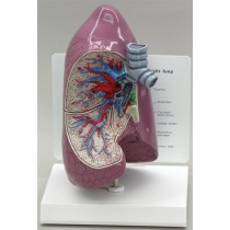 Lung - Budget Model