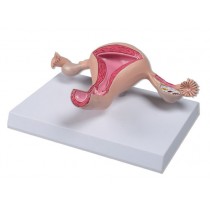 Uterus Model