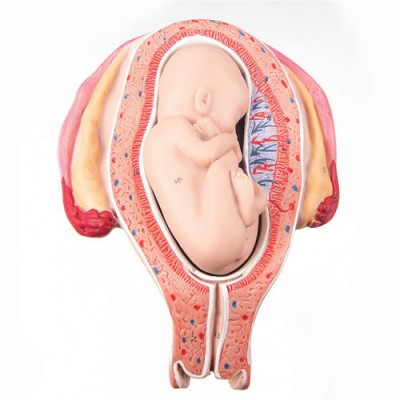 Uterus With Foetus, 4-5th Month