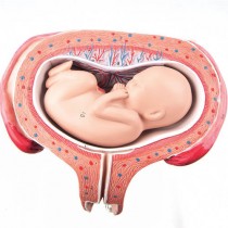 Uterus With Foetus, 5th Month, Transverse