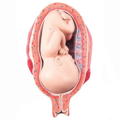 Foetus In 7th Month